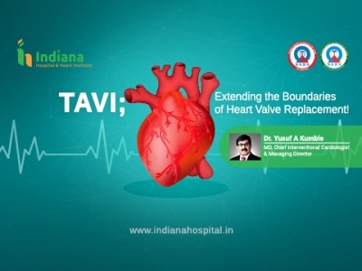 TAVI – A paradigm shift in the  management of aortic valve stenosis